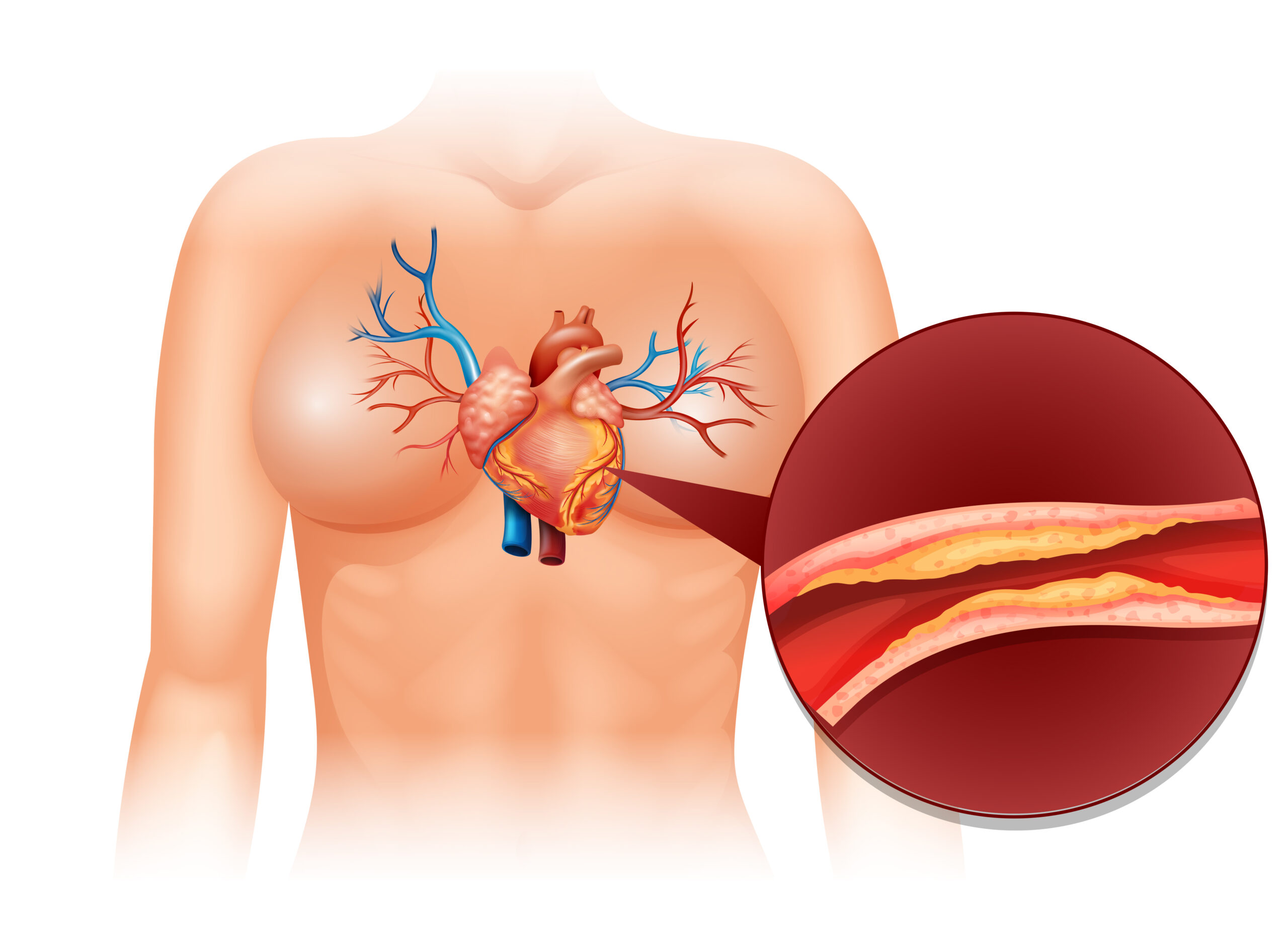 Cholesteral