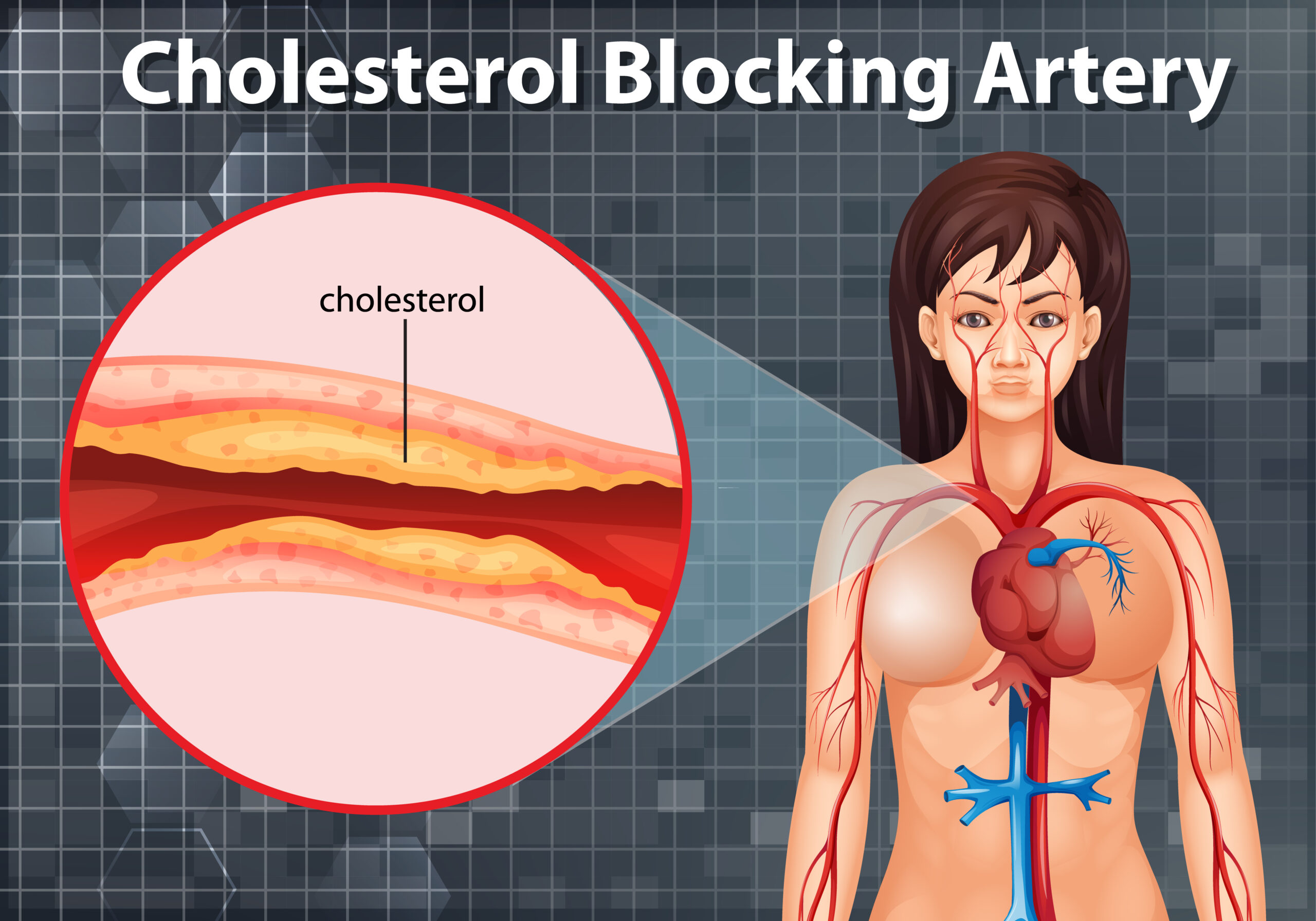 Cholesterol