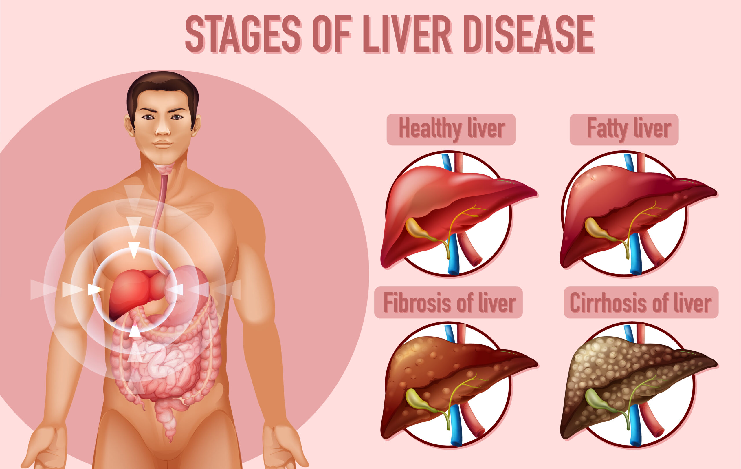 Liver Disease